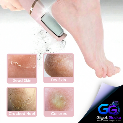 Electric Foot File